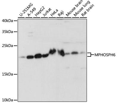 MPHOSPH6 Antibody - Western blot analysis of extracts of various cell lines using MPHOSPH6 Polyclonal Antibody at dilution of 1:1000.
