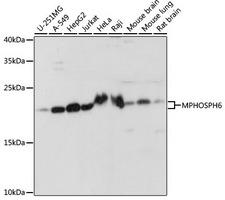 MPHOSPH6 Antibody - Western blot analysis of extracts of various cell lines using MPHOSPH6 Polyclonal Antibody at dilution of 1:1000.