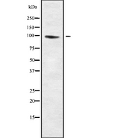 MPHOSPH8 Antibody - Western blot analysis of MPHOSPH8 using COLO205 whole cells lysates