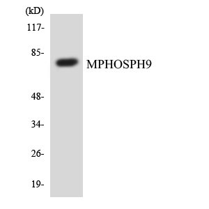 MPHOSPH9 Antibody - Western blot analysis of the lysates from COLO205 cells using MPHOSPH9 antibody.