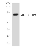 MPHOSPH9 Antibody - Western blot analysis of the lysates from COLO205 cells using MPHOSPH9 antibody.