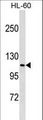 MPHOSPH9 Antibody - MPHOSPH9 Antibody western blot of HL-60 cell line lysates (35 ug/lane). The MPHOSPH9 antibody detected the MPHOSPH9 protein (arrow).