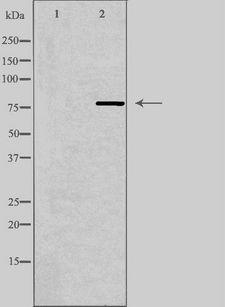 MPHOSPH9 Antibody - Western blot analysis of extracts of A549 cells using MPHOSPH9 antibody. The lane on the left is treated with the antigen-specific peptide.