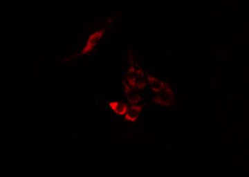 MPHOSPH9 Antibody - Staining A549 cells by IF/ICC. The samples were fixed with PFA and permeabilized in 0.1% Triton X-100, then blocked in 10% serum for 45 min at 25°C. The primary antibody was diluted at 1:200 and incubated with the sample for 1 hour at 37°C. An Alexa Fluor 594 conjugated goat anti-rabbit IgG (H+L) antibody, diluted at 1/600, was used as secondary antibody.