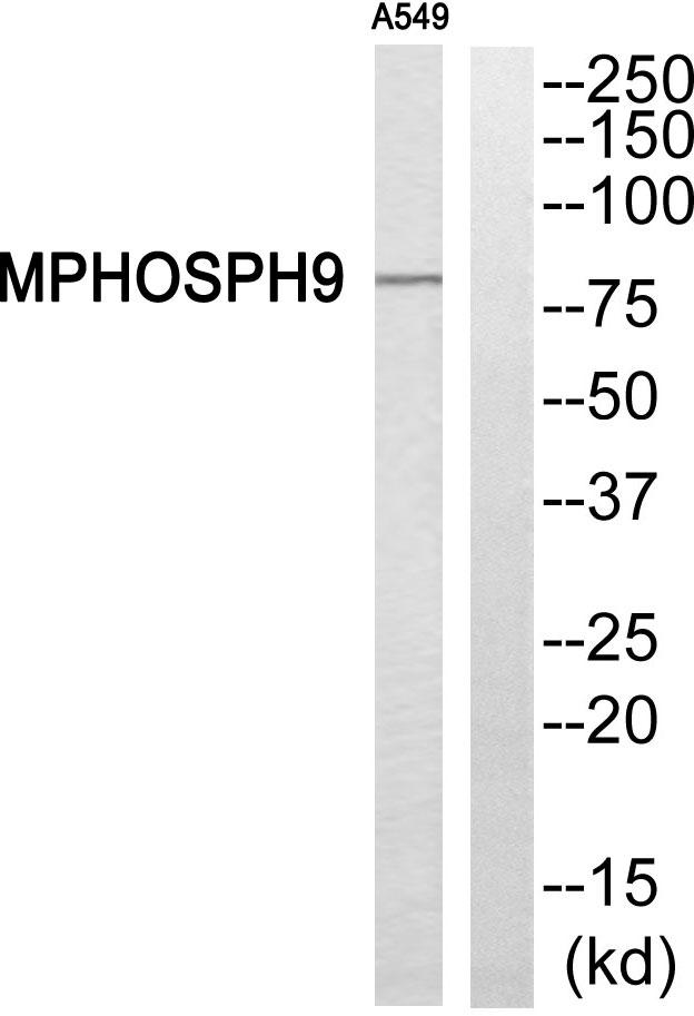 MPHOSPH9 Antibody - Western blot analysis of extracts from A549 cells, using MPHOSPH9 antibody.