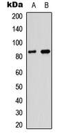 MPO / Myeloperoxidase Antibody - Western blot analysis of Myeloperoxidase LC expression in A549 (A); PC12 (B) whole cell lysates.