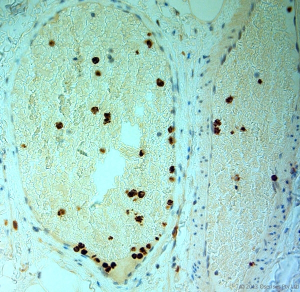 MPO / Myeloperoxidase Antibody - Rabbit antibody to MPO. IHC-P on paraffin sections of human small intestine. HIER: Tris-EDTA, pH 9 for 20 min using Thermo PT Module. Blocking: 0.2% LFDM in TBST filtered through a 0.2 micron filter. Detection was done using Novolink HRP polymer from Leica following manufacturers instructions, using DAB chromogen. Primary antibody: dilution 1:1000, incubated 30 min at RT using Autostainer. Sections were counterstained with Harris Hematoxylin. Primary antibody: dilution 1:1000, incubated 30 min at RT using Autostainer. Sections were counterstained with Harris Hematoxylin.