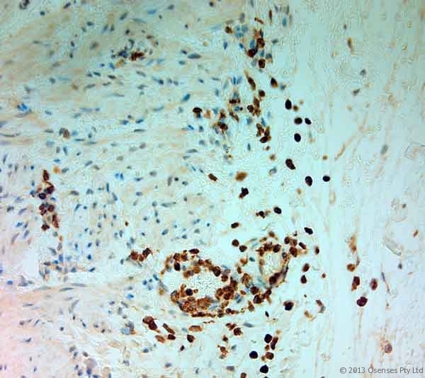 MPO / Myeloperoxidase Antibody - Rabbit antibody to MPO. IHC-P on paraffin sections of human small intestine. HIER: Tris-EDTA, pH 9 for 20 min using Thermo PT Module. Blocking: 0.2% LFDM in TBST filtered through a 0.2 micron filter. Detection was done using Novolink HRP polymer from Leica following manufacturers instructions, using DAB chromogen. Primary antibody: dilution 1:1000, incubated 30 min at RT using Autostainer. Sections were counterstained with Harris Hematoxylin. Primary antibody: dilution 1:1000, incubated 30 min at RT using Autostainer. Sections were counterstained with Harris Hematoxylin.