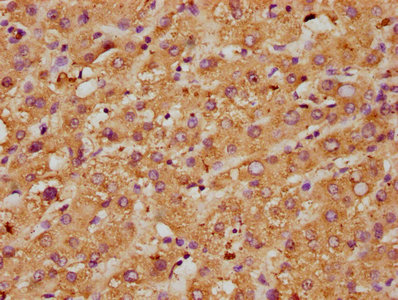 MPO / Myeloperoxidase Antibody - IHC image of MPO Antibody diluted at 1:600 and staining in paraffin-embedded human liver tissue performed on a Leica BondTM system. After dewaxing and hydration, antigen retrieval was mediated by high pressure in a citrate buffer (pH 6.0). Section was blocked with 10% normal goat serum 30min at RT. Then primary antibody (1% BSA) was incubated at 4°C overnight. The primary is detected by a biotinylated secondary antibody and visualized using an HRP conjugated SP system.