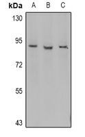 MPO / Myeloperoxidase Antibody - Western blot analysis of Myeloperoxidase 89k expression in Jurkat (A), K562 (B), SP20 (C) whole cell lysates.