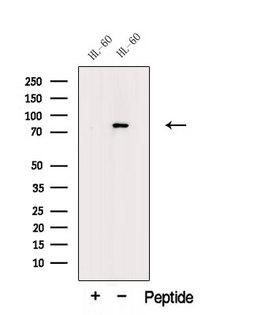MPO / Myeloperoxidase Antibody - Western blot analysis of extracts of HL-60 cells using PERM antibody. The lane on the left was treated with blocking peptide.