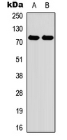 MPO / Myeloperoxidase Antibody - Western blot analysis of Myeloperoxidase expression in HEK293T (A); Raw264.7 (B) whole cell lysates.