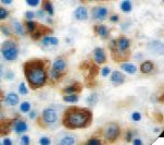 MPO / Myeloperoxidase Antibody - IHC of Myeloperoxidase on FFPE Bone Marrow tissue. This image was taken for the unmodified form of this product. Other forms have not been tested.