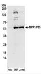 MPP1 Antibody - Detection of Human MPP1/P55 by Western Blot. Samples: Whole cell lysate (50 ug) prepared using RIPA buffer from HeLa, 293T, and Jurkat cells. Antibodies: Affinity purified rabbit anti-MPP1/P55 antibody used for WB at 0.4 ug/ml. Detection: Chemiluminescence with an exposure time of 3 minutes.
