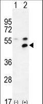 MPP1 Antibody - Western blot of MPP1 (arrow) using rabbit polyclonal MPP1 Antibody. 293 cell lysates (2 ug/lane) either nontransfected (Lane 1) or transiently transfected (Lane 2) with the MPP1 gene.