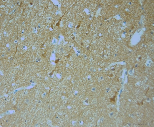 MPP1 Antibody - Rabbit antibody to MPP1 (410-460). IHC-P on paraffin sections of human brain. HIER: Tris-EDTA, pH 9 for 20 min using Thermo PT Module. Blocking: 0.2% LFDM in TBST filtered through a 0.2 micron filter. Detection was done using Novolink HRP polymer from Leica following manufacturers instructions. Primary antibody: dilution 1:1000, incubated 30 min at RT (using Autostainer). Sections were counterstained with Harris Hematoxylin.