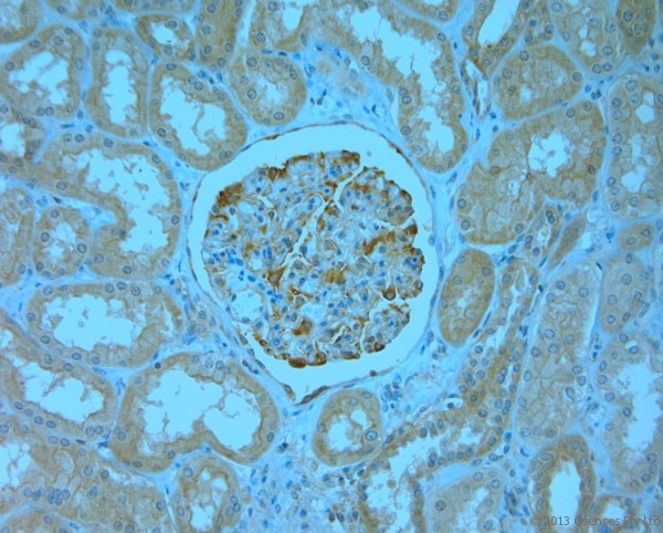 MPP1 Antibody - Rabbit antibody to MPP1 (410-460). IHC-P on paraffin sections of human kidney. HIER: Tris-EDTA, pH 9 for 20 min using Thermo PT Module. Blocking: 0.2% LFDM in TBST filtered through a 0.2 micron filter. Detection was done using Novolink HRP polymer from Leica following manufacturers instructions. Primary antibody: dilution 1:1000, incubated 30 min at RT (using Autostainer). Sections were counterstained with Harris Hematoxylin.