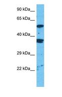 MPP1 Antibody - Western blot of EM55 Antibody with human Jurkat Whole Cell lysate.  This image was taken for the unconjugated form of this product. Other forms have not been tested.
