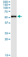 MPP1 Antibody - MPP1 monoclonal antibody (M01), clone 1E11-1G11. Western Blot analysis of MPP1 expression in human placenta.
