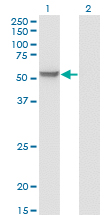 MPP1 Antibody - Western Blot analysis of MPP1 expression in transfected 293T cell line by MPP1 monoclonal antibody (M01), clone 1E11-1G11.Lane 1: MPP1 transfected lysate (Predicted MW: 52.3 KDa).Lane 2: Non-transfected lysate.