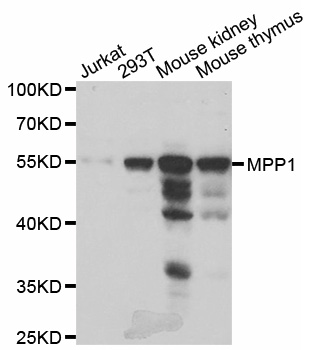 MPP1 Antibody - Western blot analysis of extracts of various cell lines.