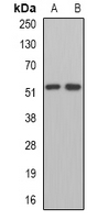 MPP1 Antibody - Western blot analysis of MPP1 expression in Jurkat (A); mouse kidney (B) whole cell lysates.