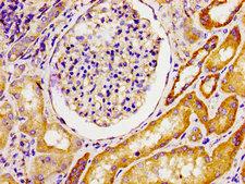 MPP1 Antibody - Immunohistochemistry image of paraffin-embedded human kidney tissue at a dilution of 1:100