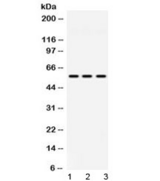 MPP1 Antibody - Western blot testing of 1) rat lung, 2) mouse spleen and 3) human MCF7 lysate with MPP1 antibody at 0.5ug/ml. Predicted/observed molecular weight 52-55 kDa.