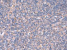 MPP1 Antibody - Immunohistochemistry of paraffin-embedded Human tonsil tissue  using MPP1 Polyclonal Antibody at dilution of 1:50(×200)