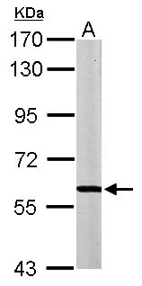 MPP2 Antibody - Sample (50 ug of whole cell lysate). A: Mouse brain. 7.5% SDS PAGE. MPP2 antibody diluted at 1:1000.