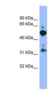 MPP2 Antibody - MPP2 antibody Western blot of 293T cell lysate. This image was taken for the unconjugated form of this product. Other forms have not been tested.