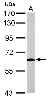 MPP2 Antibody - Sample (50 ug of whole cell lysate). A: Mouse brain. 7.5% SDS PAGE. MPP2 antibody diluted at 1:1000.