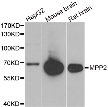 MPP2 Antibody - Western blot analysis of extracts of various cell lines.