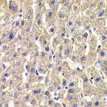 MPP2 Antibody - Immunohistochemistry of paraffin-embedded Human liver injury tissue.