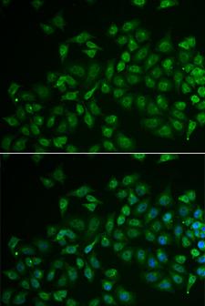 MPP2 Antibody - Immunofluorescence analysis of U2OS cells.