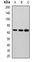 MPP2 Antibody - Western blot analysis of MPP2 expression in HepG2 (A); mouse brain (B); rat brain (C) whole cell lysates.