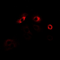MPP2 Antibody - Immunofluorescent analysis of MPP2 staining in U2OS cells. Formalin-fixed cells were permeabilized with 0.1% Triton X-100 in TBS for 5-10 minutes and blocked with 3% BSA-PBS for 30 minutes at room temperature. Cells were probed with the primary antibody in 3% BSA-PBS and incubated overnight at 4 deg C in a humidified chamber. Cells were washed with PBST and incubated with a DyLight 594-conjugated secondary antibody (red) in PBS at room temperature in the dark.