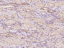 MPP2 Antibody - Immunochemical staining of human MPP2 in human kidney with rabbit polyclonal antibody at 1:100 dilution, formalin-fixed paraffin embedded sections.