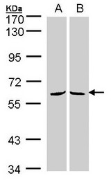 MPP3 Antibody - Sample (30 ug whole cell lysate). A:293T, B: H1299. 7.5% SDS PAGE. MPP3 antibody diluted at 1:1000