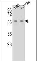 MPP3 Antibody - MPP3 Antibody western blot of K562,NCI-H292 cell line lysates (35 ug/lane). The MPP3 antibody detected the MPP3 protein (arrow).