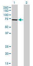 MPP3 Antibody - Western Blot analysis of MPP3 expression in transfected 293T cell line by MPP3 monoclonal antibody (M01), clone 4D7.Lane 1: MPP3 transfected lysate(66.2 KDa).Lane 2: Non-transfected lysate.