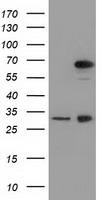 MPP3 Antibody - HEK293T cells were transfected with the pCMV6-ENTRY control (Left lane) or pCMV6-ENTRY MPP3 (Right lane) cDNA for 48 hrs and lysed. Equivalent amounts of cell lysates (5 ug per lane) were separated by SDS-PAGE and immunoblotted with anti-MPP3.