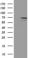 MPP3 Antibody - HEK293T cells were transfected with the pCMV6-ENTRY control (Left lane) or pCMV6-ENTRY MPP3 (Right lane) cDNA for 48 hrs and lysed. Equivalent amounts of cell lysates (5 ug per lane) were separated by SDS-PAGE and immunoblotted with anti-MPP3.