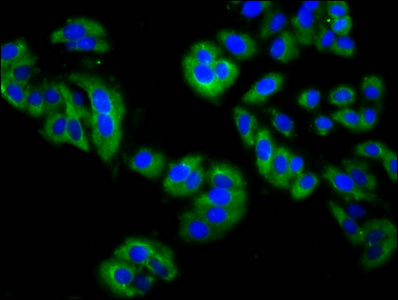 MPP3 Antibody - Immunofluorescence staining of HepG2 cells diluted at 1:200, counter-stained with DAPI. The cells were fixed in 4% formaldehyde, permeabilized using 0.2% Triton X-100 and blocked in 10% normal Goat Serum. The cells were then incubated with the antibody overnight at 4°C.The Secondary antibody was Alexa Fluor 488-congugated AffiniPure Goat Anti-Rabbit IgG (H+L).