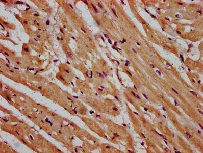 MPP3 Antibody - Immunohistochemistry Dilution at 1:600 and staining in paraffin-embedded human heart tissue performed on a Leica BondTM system. After dewaxing and hydration, antigen retrieval was mediated by high pressure in a citrate buffer (pH 6.0). Section was blocked with 10% normal Goat serum 30min at RT. Then primary antibody (1% BSA) was incubated at 4°C overnight. The primary is detected by a biotinylated Secondary antibody and visualized using an HRP conjugated SP system.