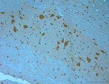 MPP4 / Discs Large Homolog 6 Antibody - Rabbit antibody to MPP4 (590-635). IHC on paraffin sections of rat spinal cord tissue. The animal was perfused using Autoperfuser at a pressure of 110 mm Hg with 300 ml 4% FA and further post fixed overnight before being processed for paraffin embedding. HIER: Tris-EDTA, pH 9 for 20 min using Thermo PT Module. Blocking: 0.2% LFDM in TBST filtered through a 0.2 micron filter. Detection was done using Novolink HRP polymer from Leica following manufacturers instructions. Primary antibody: dilution 1:1000, incubated 30 min at RT (using Autostainer). Sections were counterstained with Harris Hematoxylin.