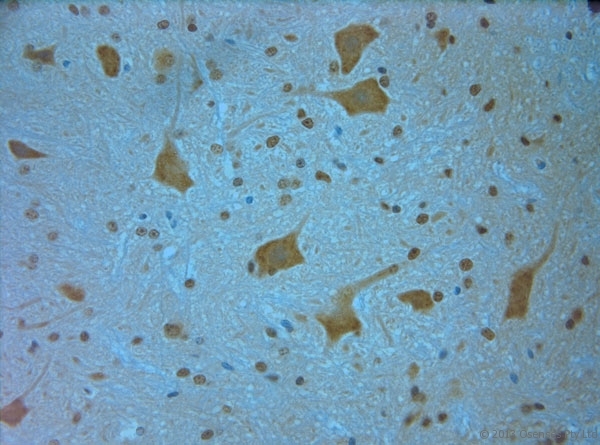 MPP4 / Discs Large Homolog 6 Antibody - Rabbit antibody to MPP4 (590-635). IHC on paraffin sections of rat spinal cord tissue. The animal was perfused using Autoperfuser at a pressure of 110 mm Hg with 300 ml 4% FA and further post fixed overnight before being processed for paraffin embedding. HIER: Tris-EDTA, pH 9 for 20 min using Thermo PT Module. Blocking: 0.2% LFDM in TBST filtered through a 0.2 micron filter. Detection was done using Novolink HRP polymer from Leica following manufacturers instructions. Primary antibody: dilution 1:1000, incubated 30 min at RT (using Autostainer). Sections were counterstained with Harris Hematoxylin.