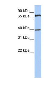 MPP5 Antibody - MPP5 antibody Western blot of Jurkat lysate. This image was taken for the unconjugated form of this product. Other forms have not been tested.