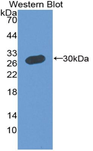 MPP5 Antibody - Western blot of recombinant MPP5.