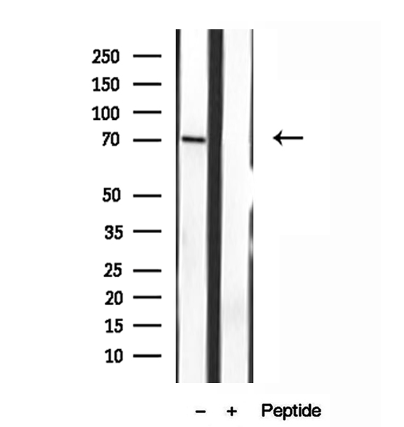 MPP5 Antibody - Western blot analysis of extracts of Y79 cells using MPP5 antibody.